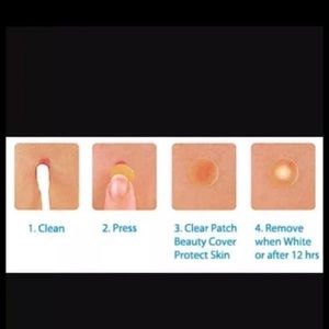 36 acne care/ Treatment/ pat ch